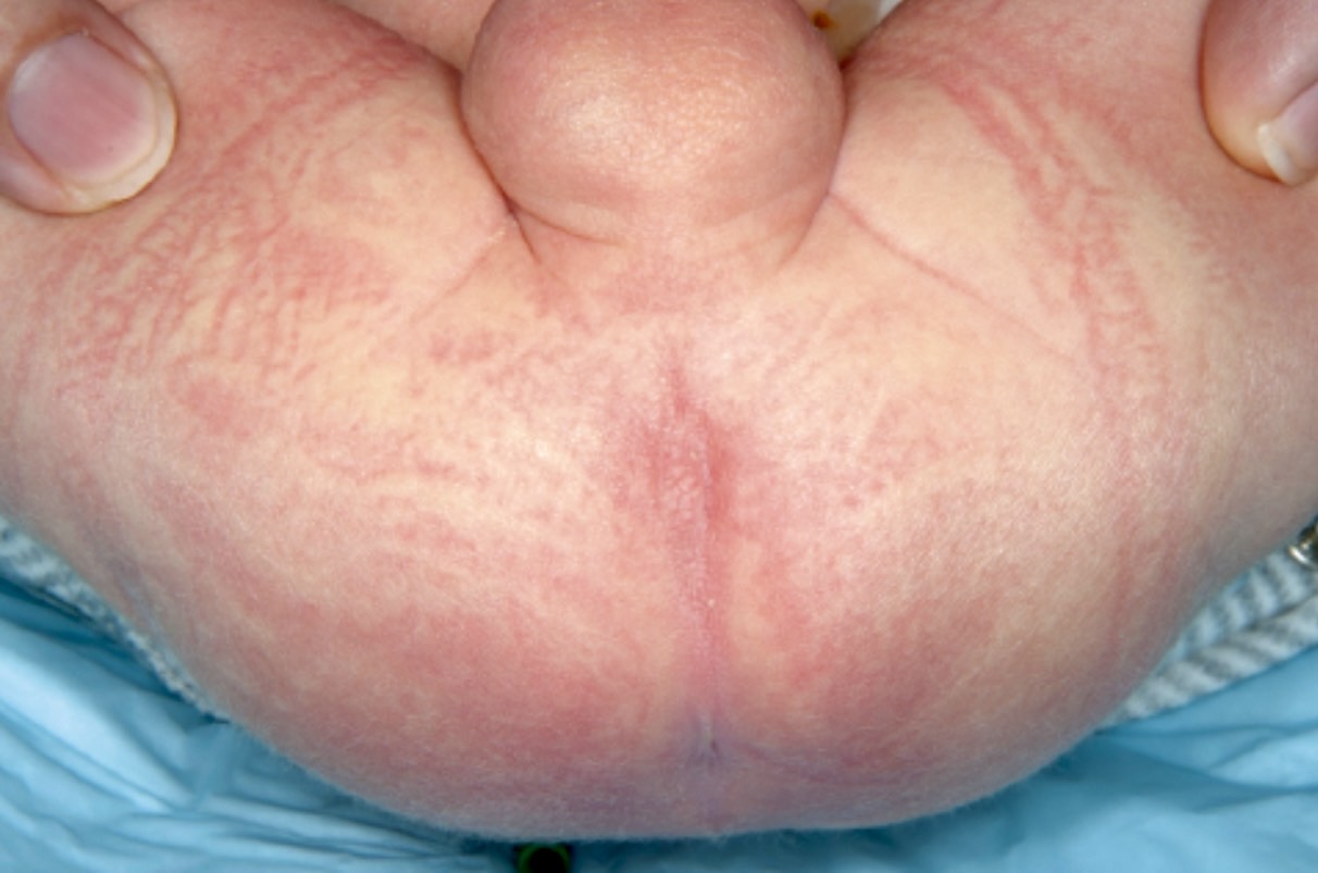 Clinical Case Slide